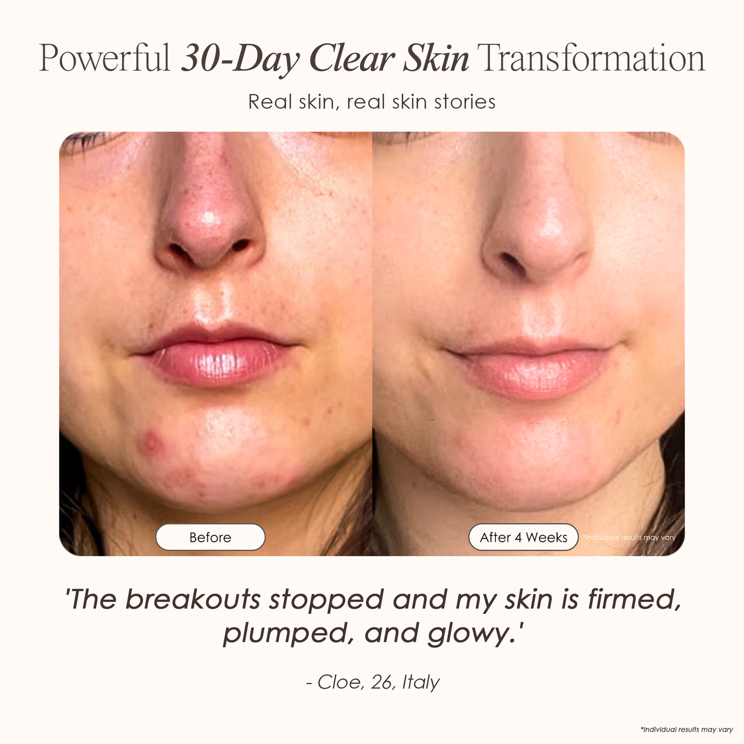 DermaVolt