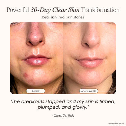 DermaVolt