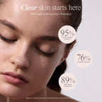 Lunvere™ Blackhead Removal Pore Vacuum