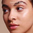 Lunvere™ Blackhead Removal Pore Vacuum