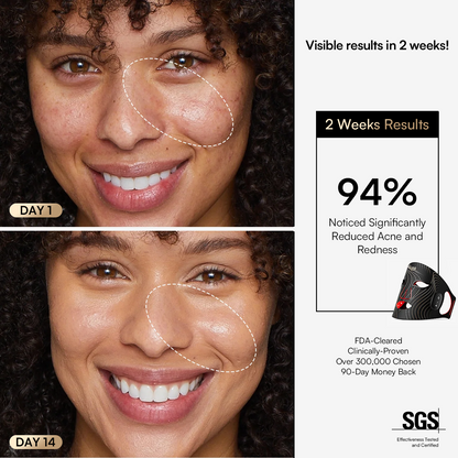 Lunvere Revé Glowmask