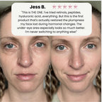 Korean Volufiline Collagen Serum