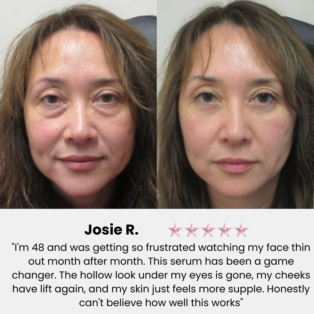 Korean Volufiline Collagen Serum